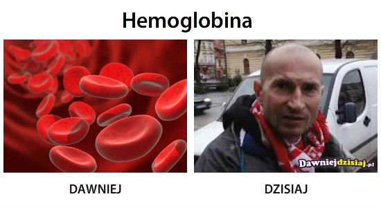 Hemoglobina –  