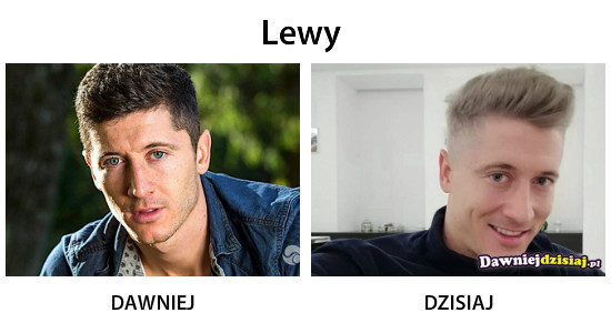 Lewy –  